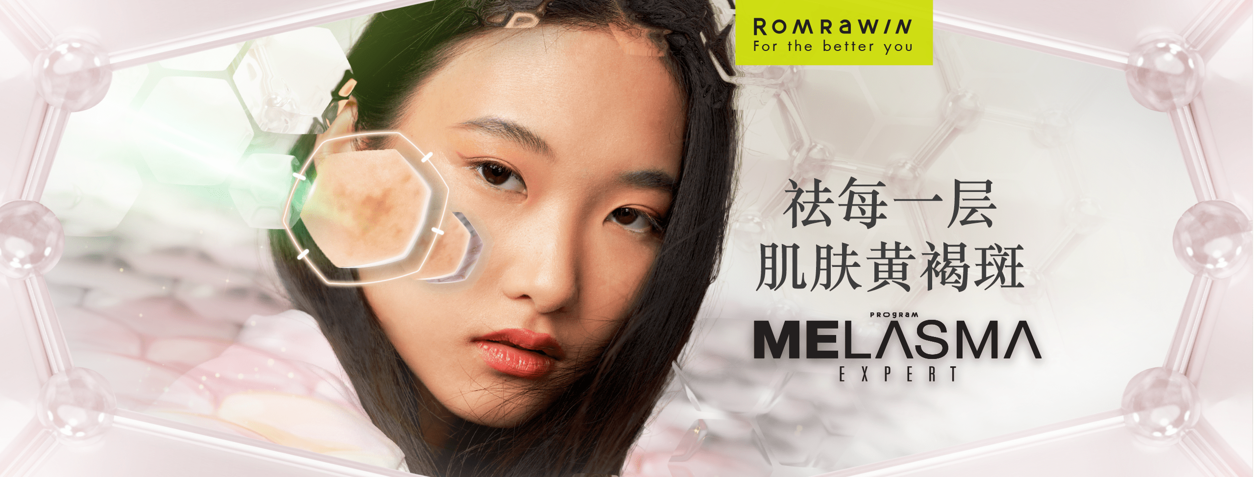 Cover Website Melasma Chinese min