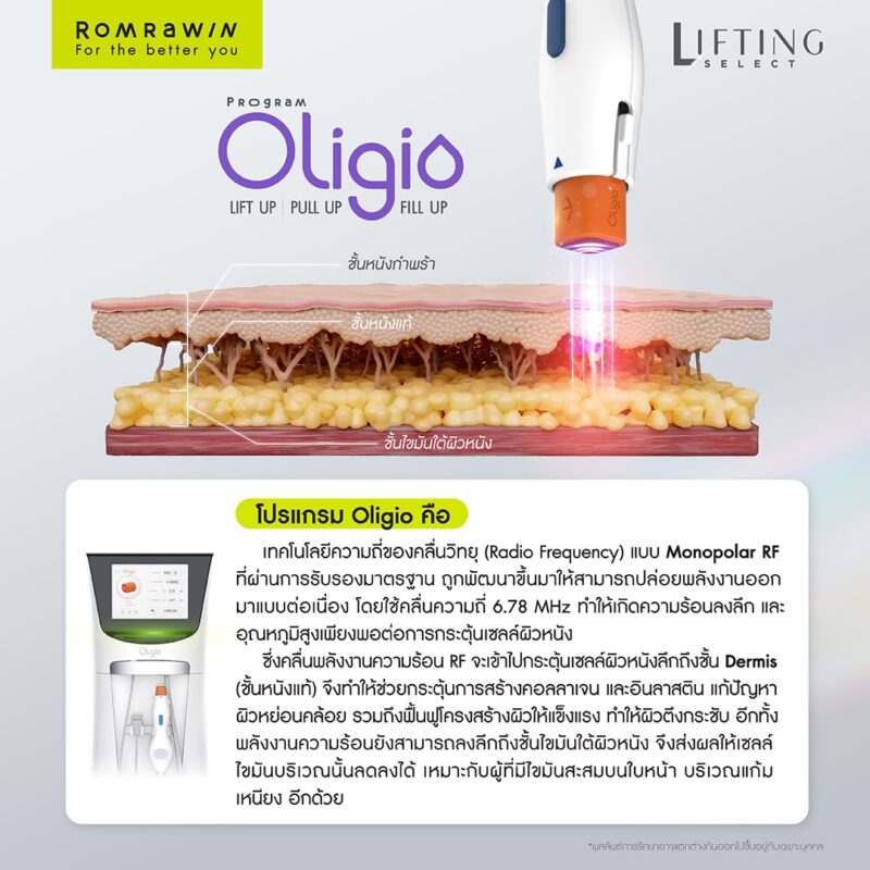 Oligio คืออะไร ? ยกกระชับใบหน้า ลดไขมันได้อย่างไร ทำไมสร้างงานผิวได้ ? 5 โปรแกรม Oligio คืออะไร