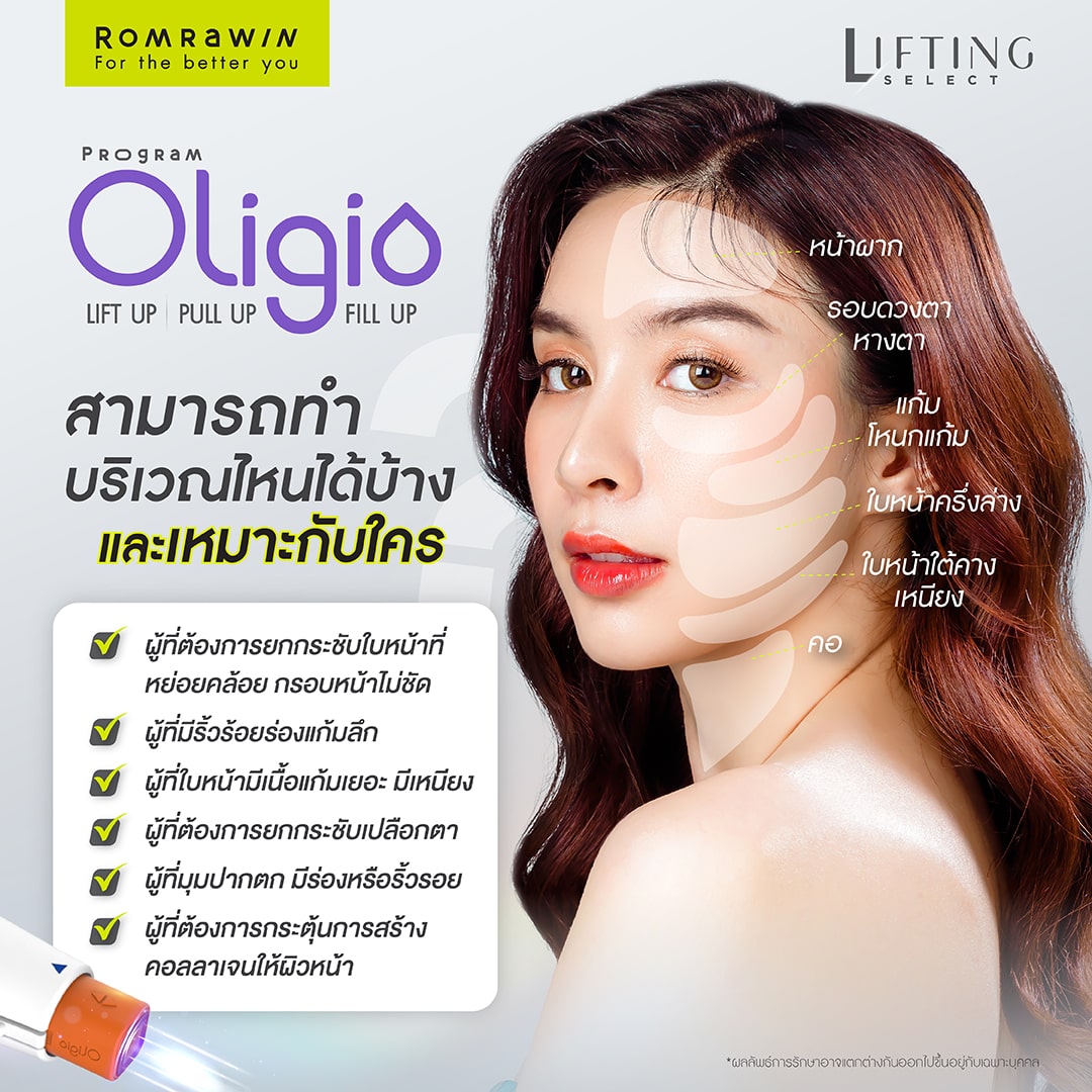 โปรแกรม Oligio เหมาะกับใครบ้าง ทำบริเวณไหนได้บ้าง