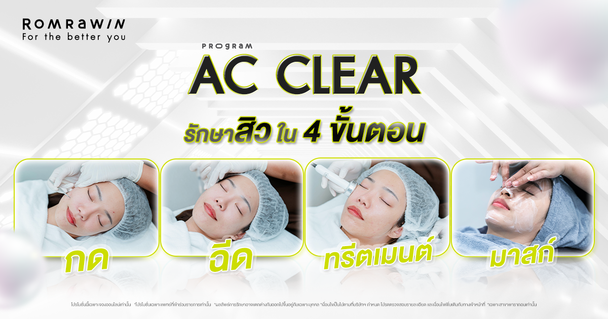 Ac clear i