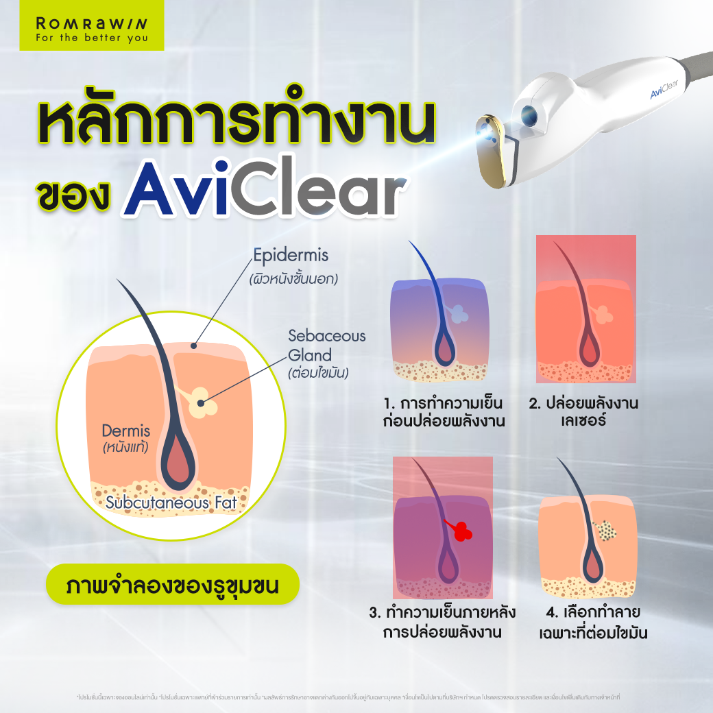 AviClear