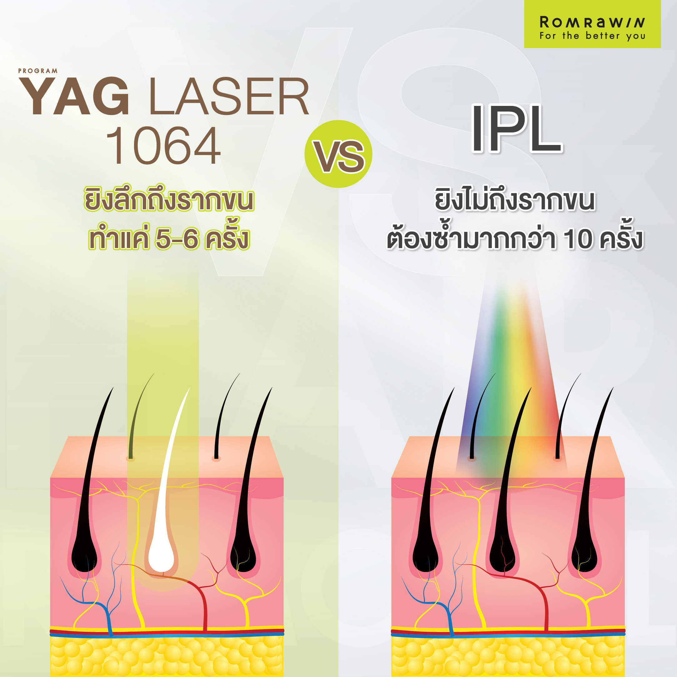 อัตรายจาก IPL