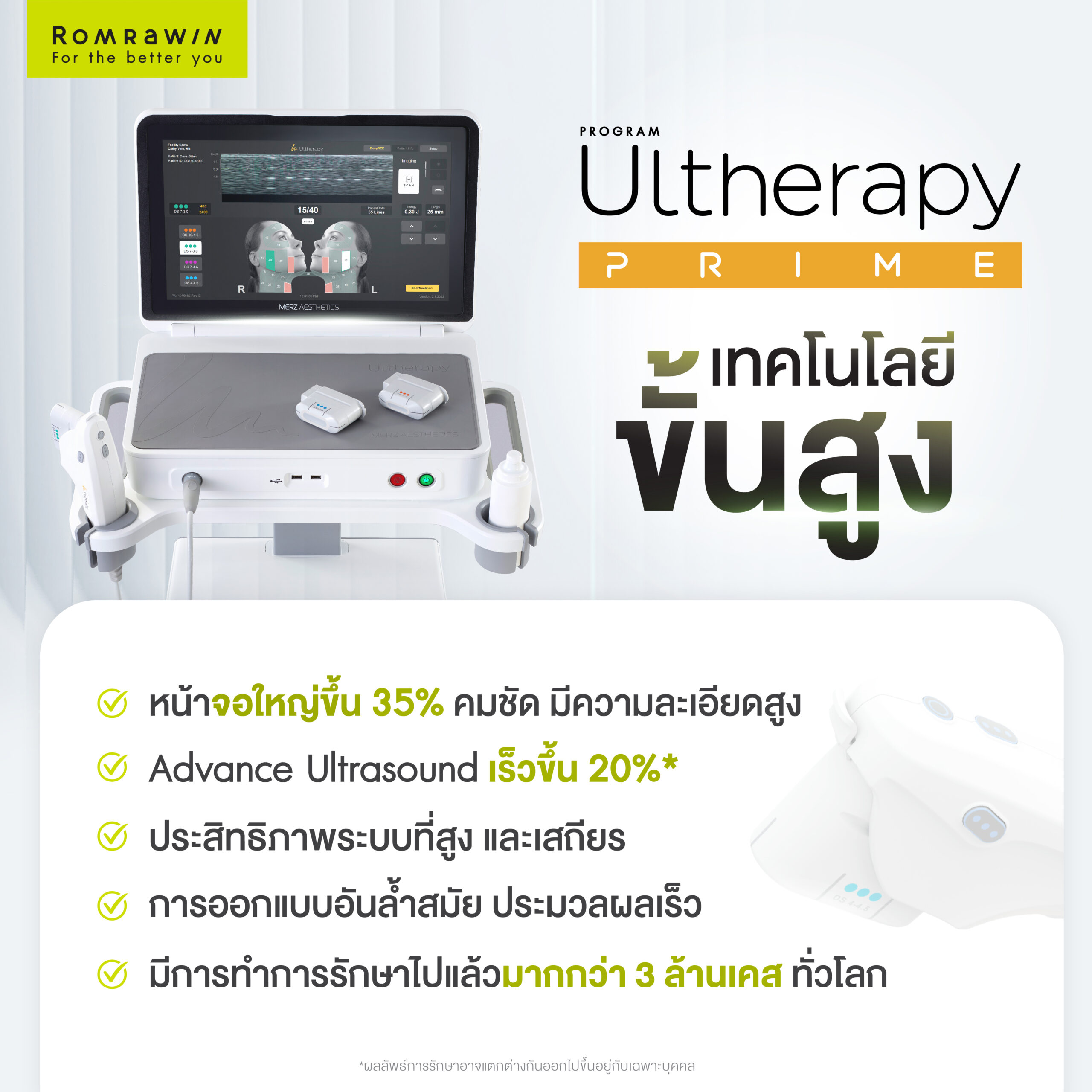 ULTHERAPY PRIME