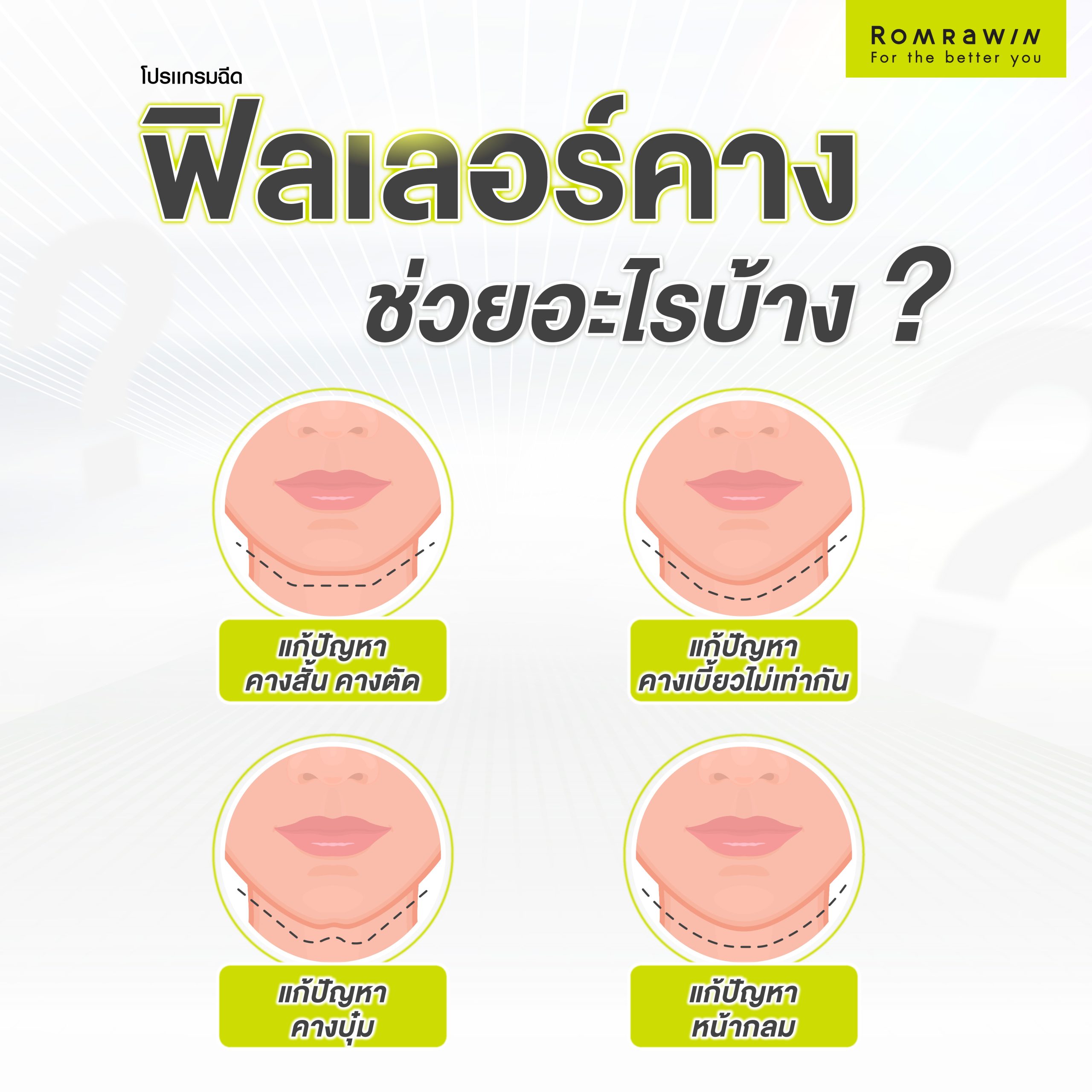 ฟิลเลอร์คาง