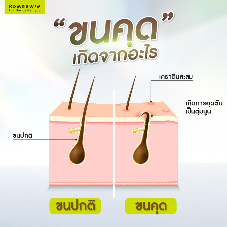 ขนคุด