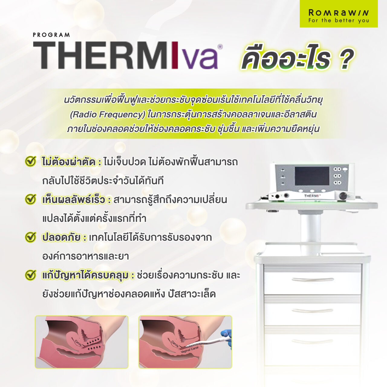 ThermiVA คืออะไร