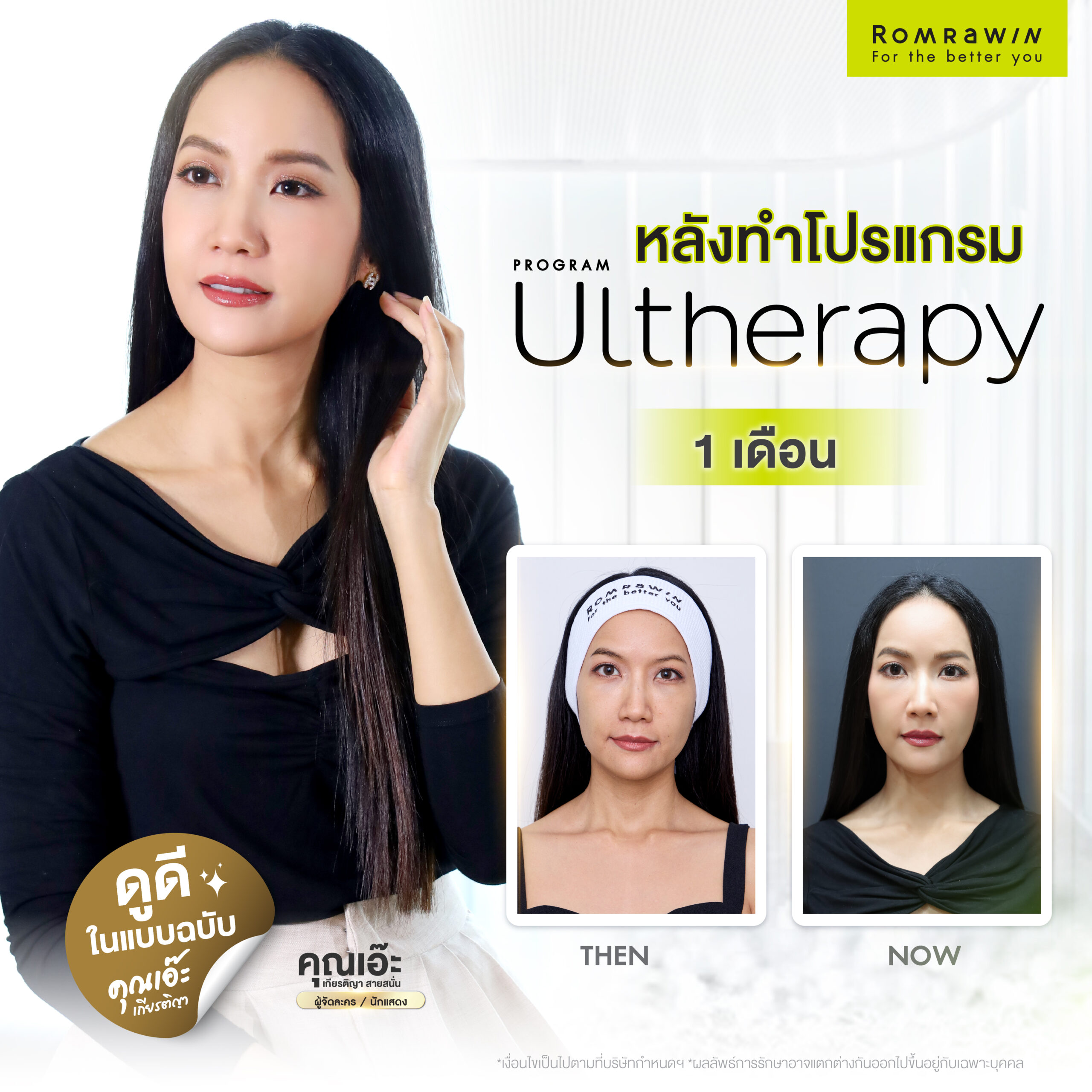 Ultherapy