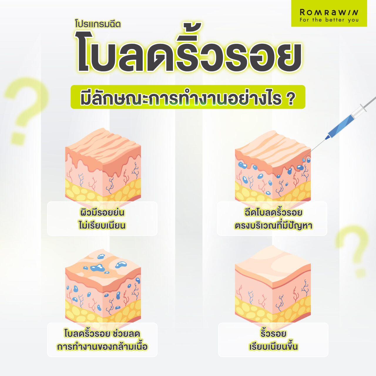 ฉีดโบ