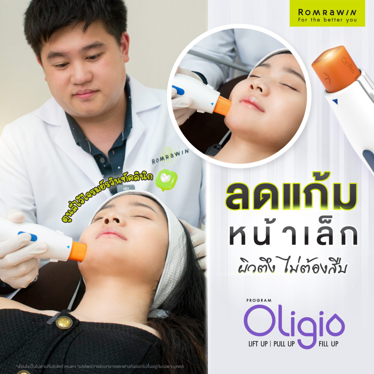 Oligio รีวิว