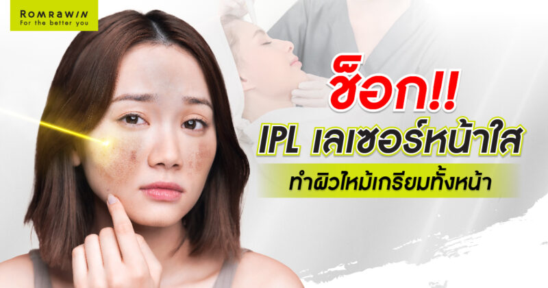 IPL Laser