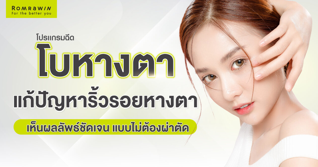 โบหางตา แก้ปัญหาริ้วรอยโดยไม่ต้องผ่าตัด