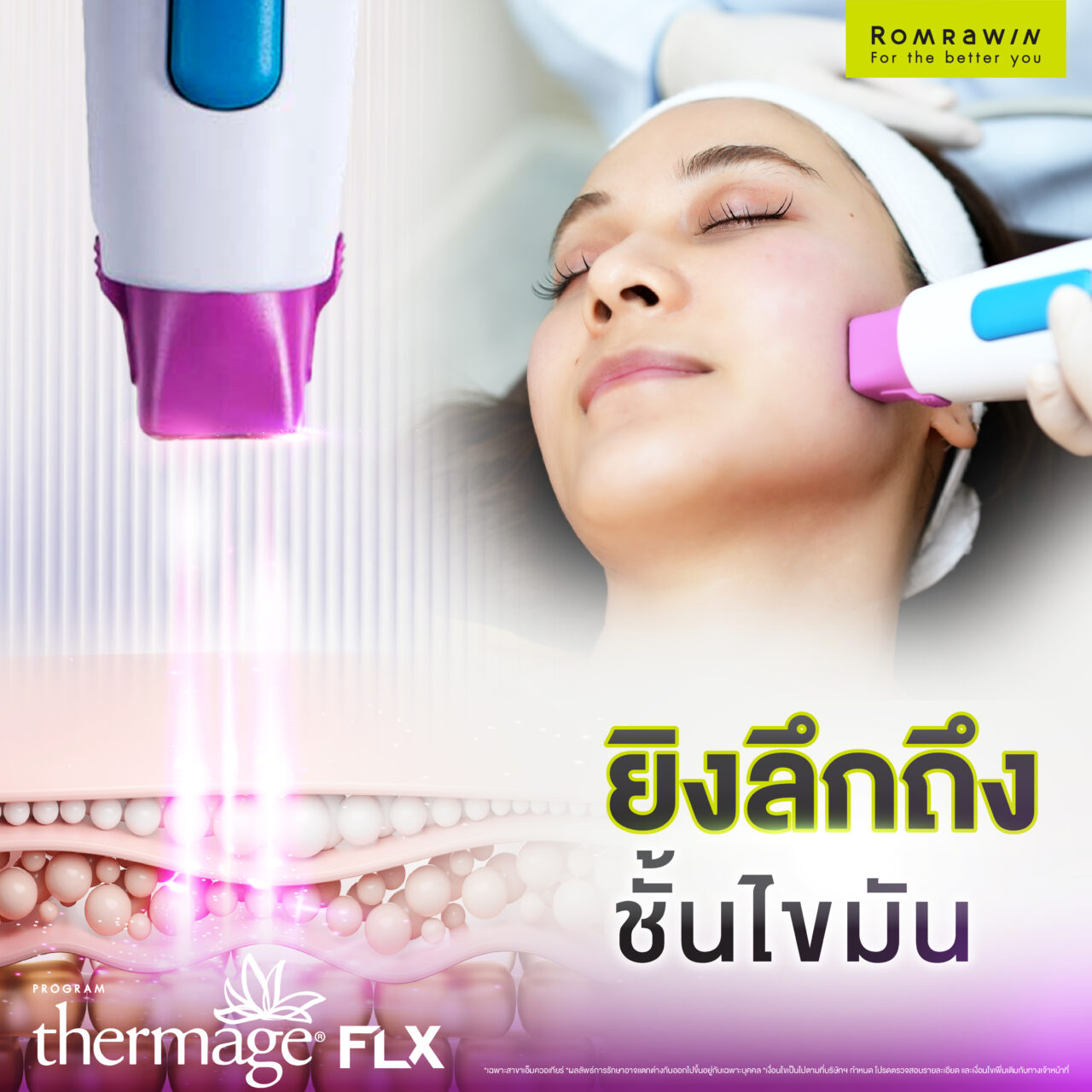 Thermage FLX