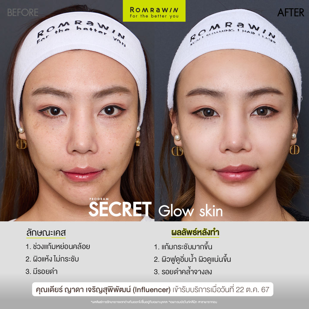 Secret Glow Skin