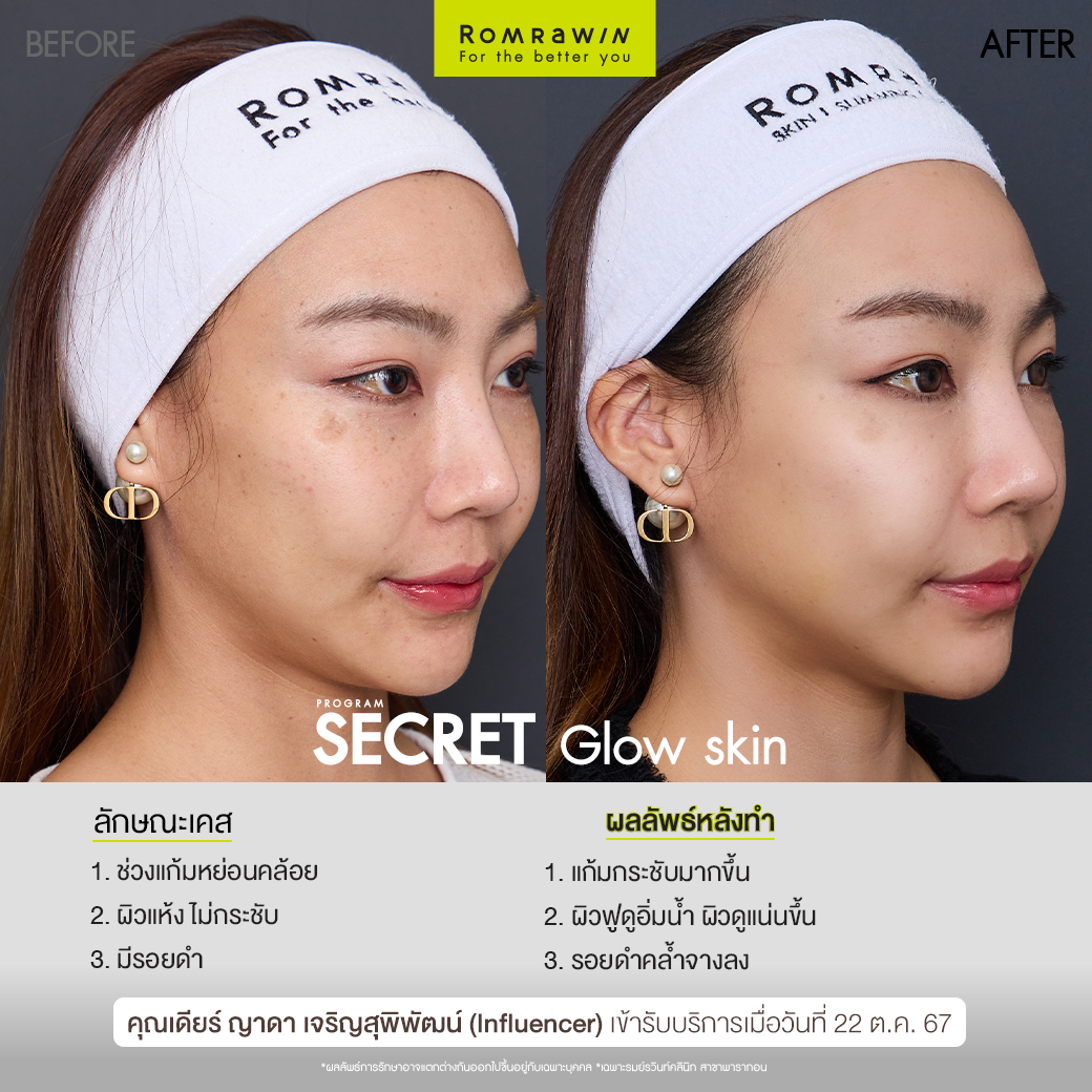 Secret Glow Skin