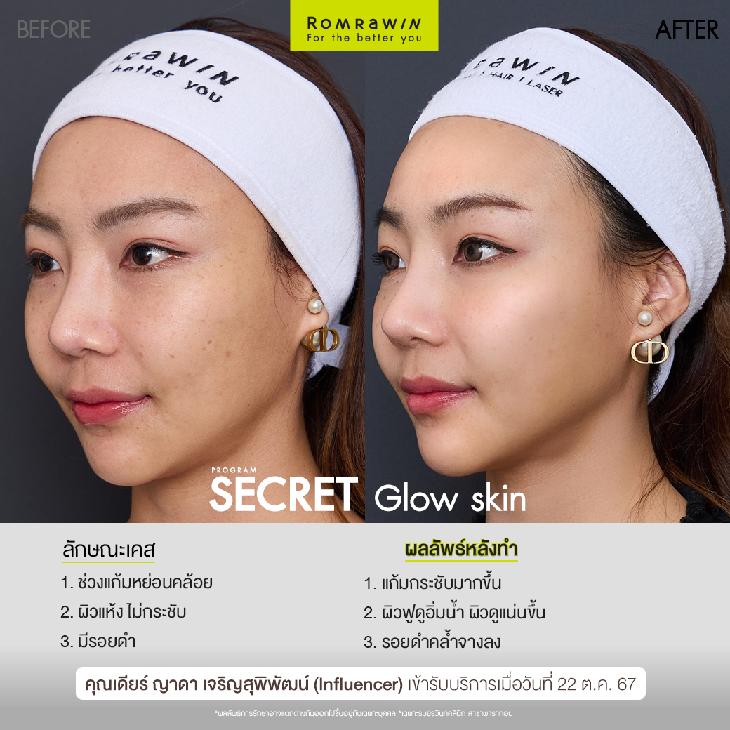 Secret Glow Skin