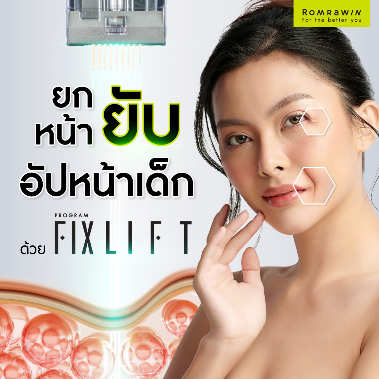 ยกหน้ายับ อัปหน้าเด็กด้วย FIX LIFT 