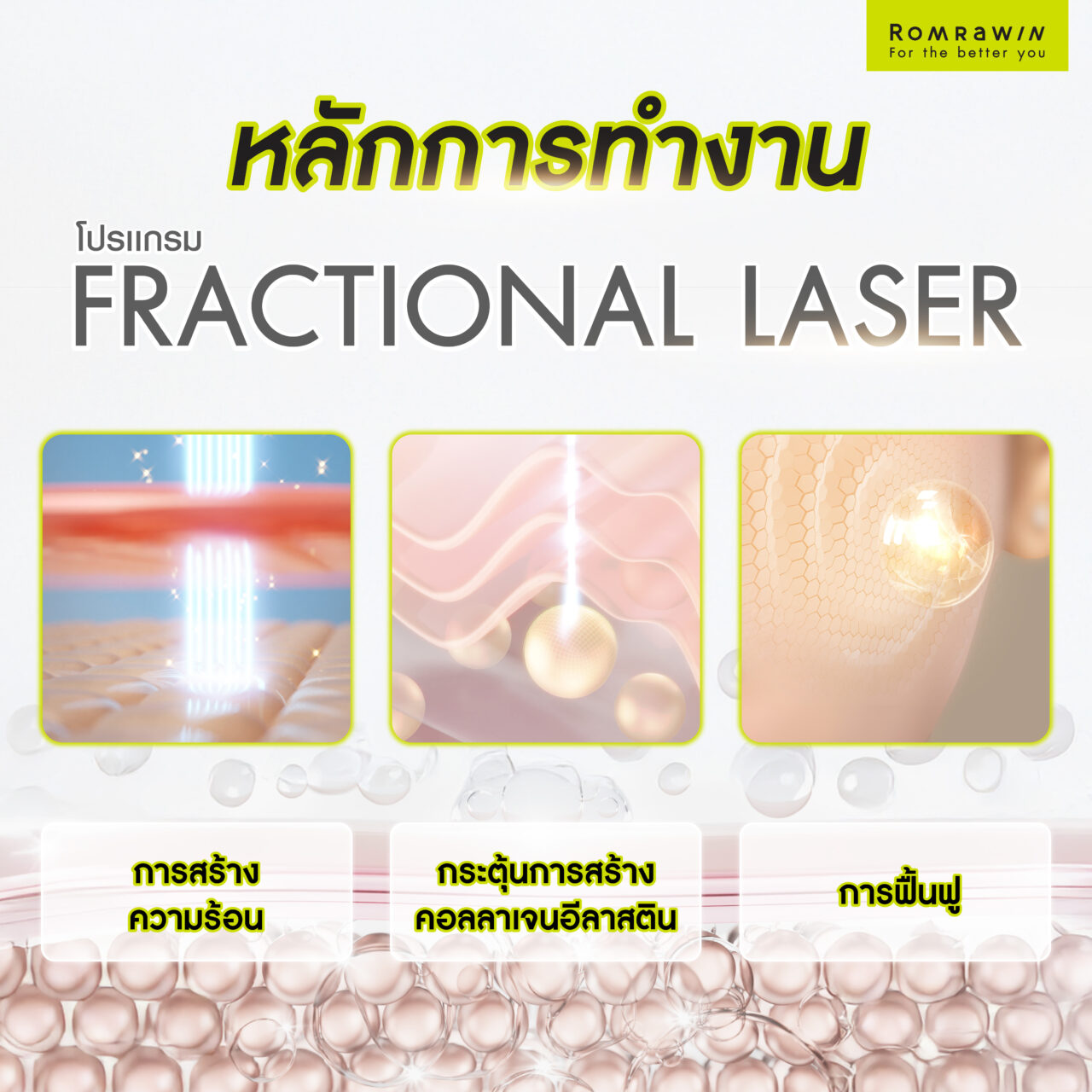 หลักหารทำงาน Fractional Laser