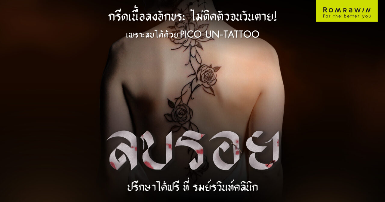 ลบรอยสัก PICO UN-TATTOO