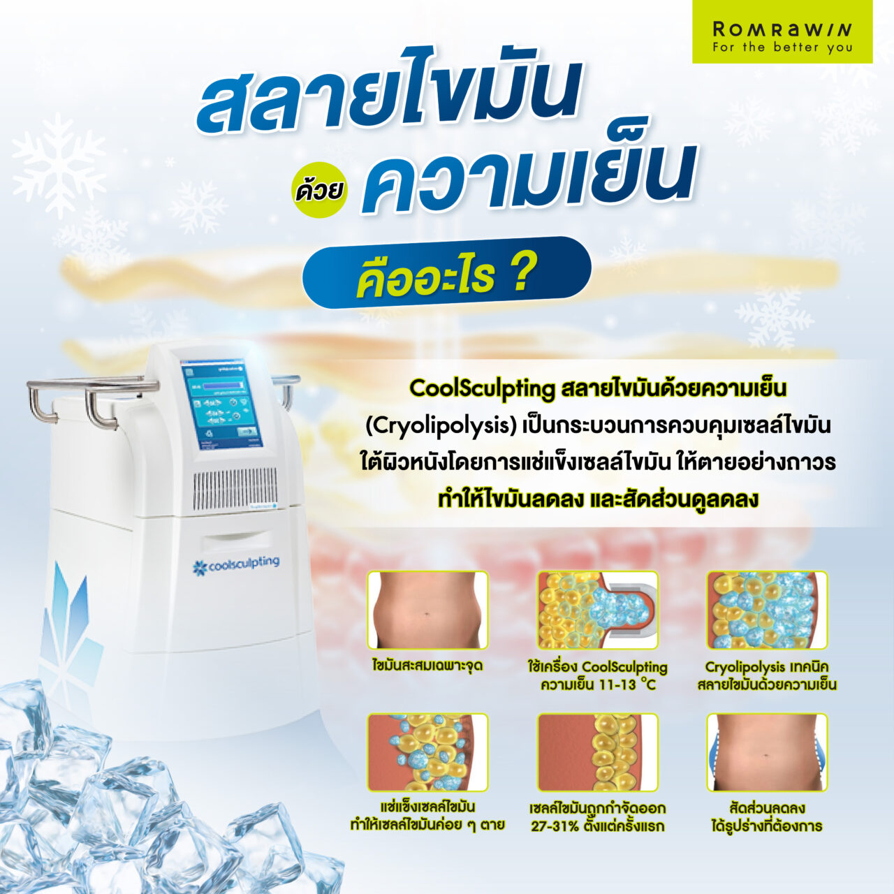 CoolSculpting สลายไขมันด้วยความเย็นคืออะไร