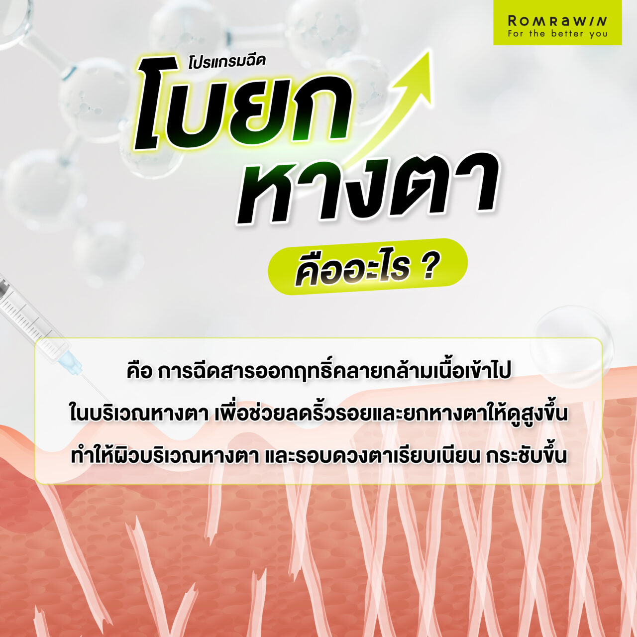 โบยกหางตา คืออะไร