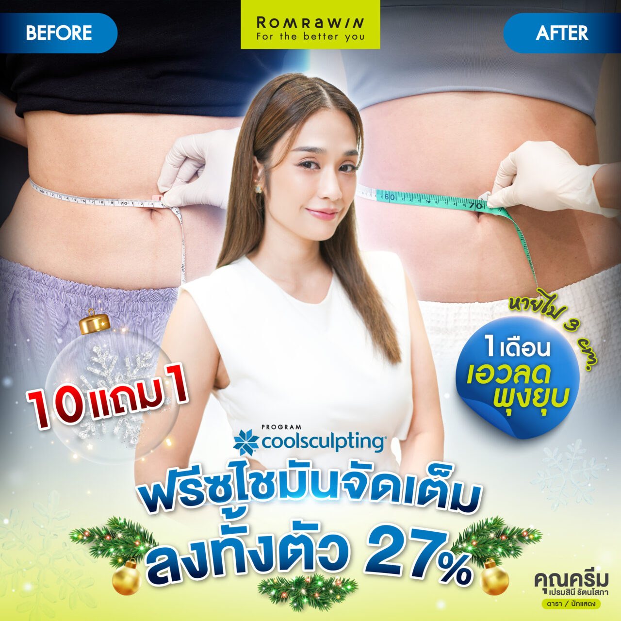 Coolsculpting คุณครีม