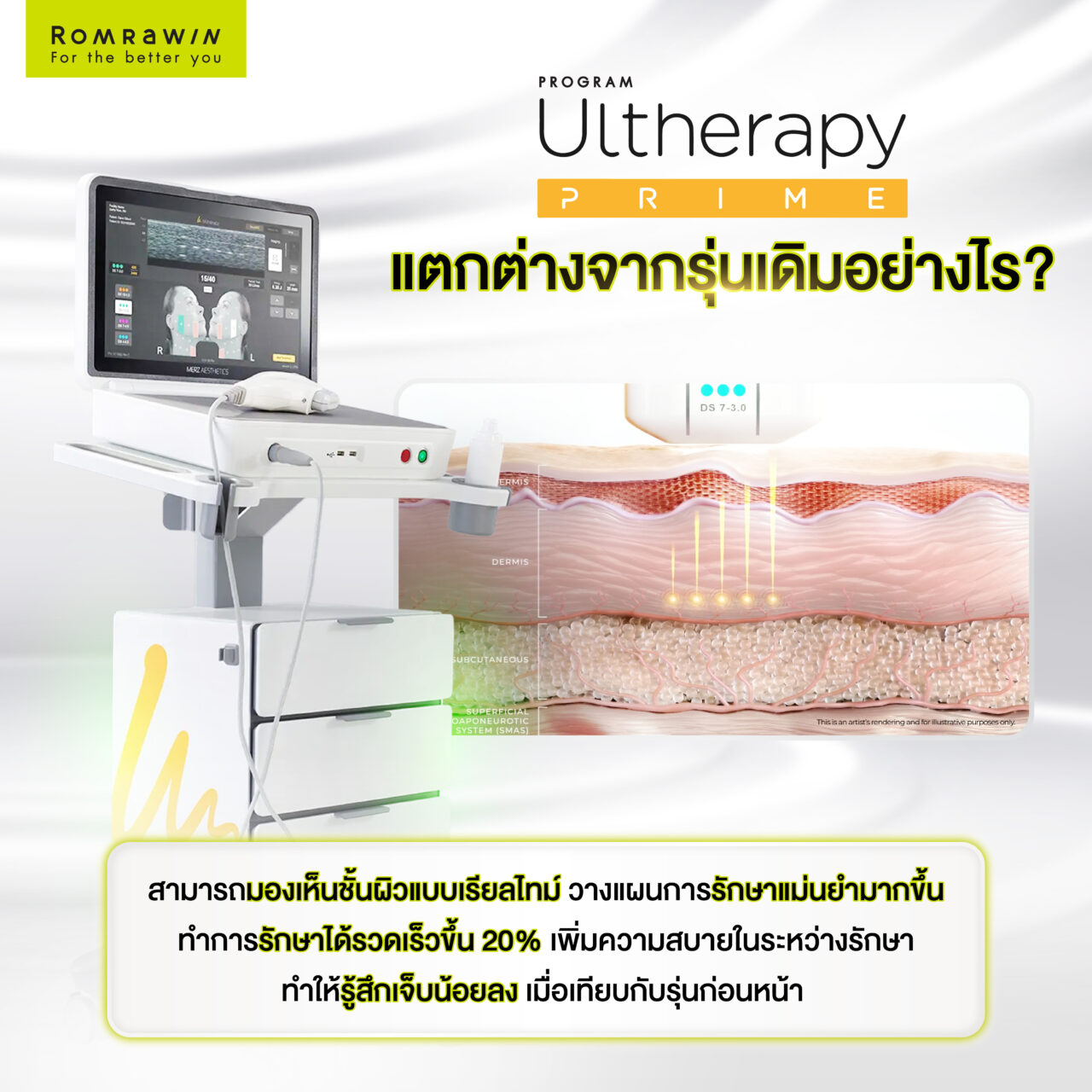 Ulthera Prime แต่ต่างจากรุ่นเดิมอย่างไร