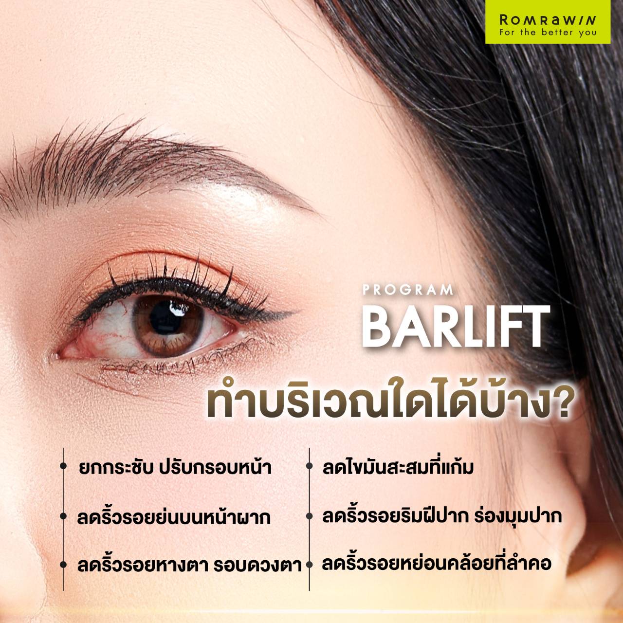 BARLIFT ทำบริเวณใดได้บ้าง