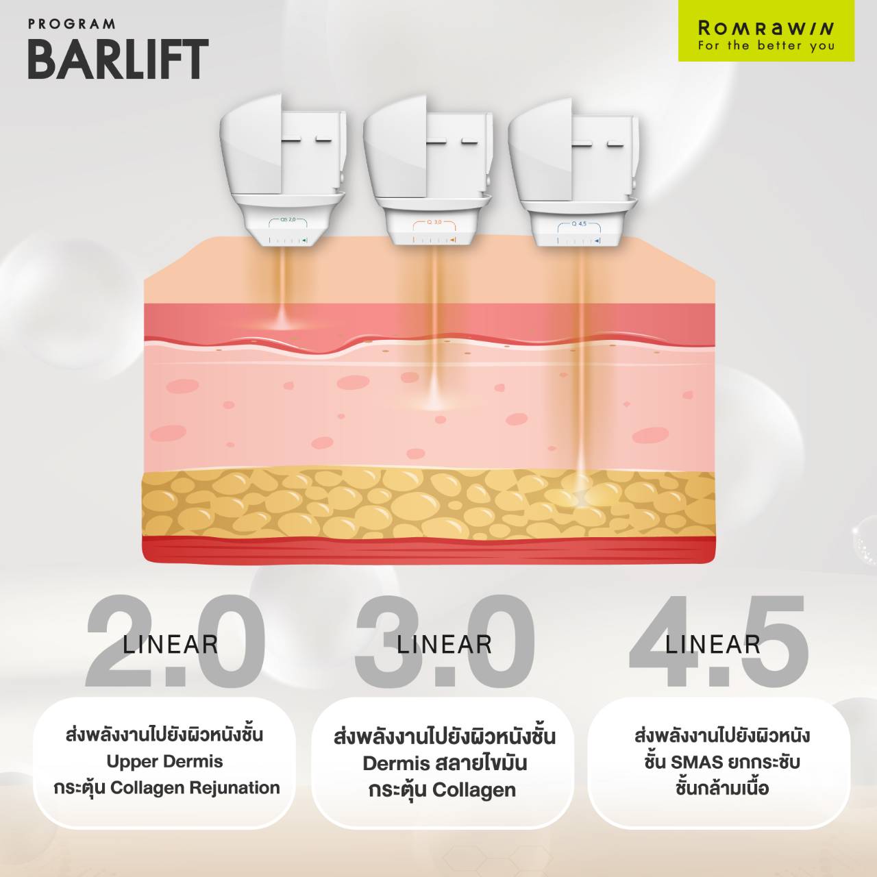 การทำงานของ BARLIFT