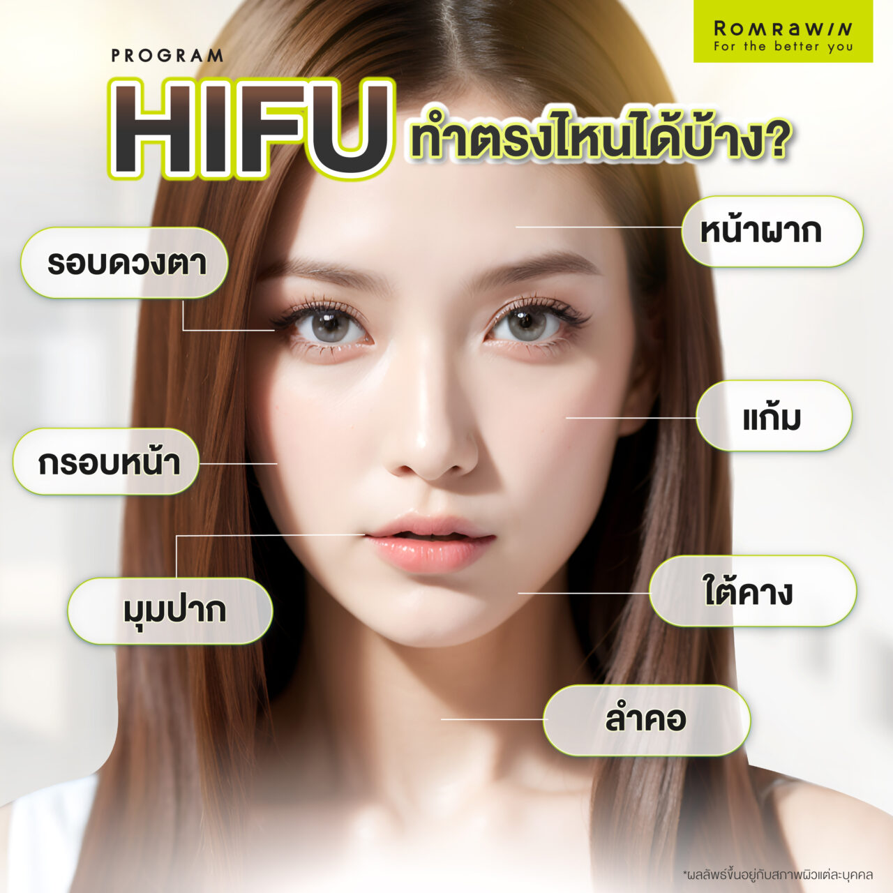 เทคโนโลยี HIFU ทำบริเวณใดได้บ้าง?