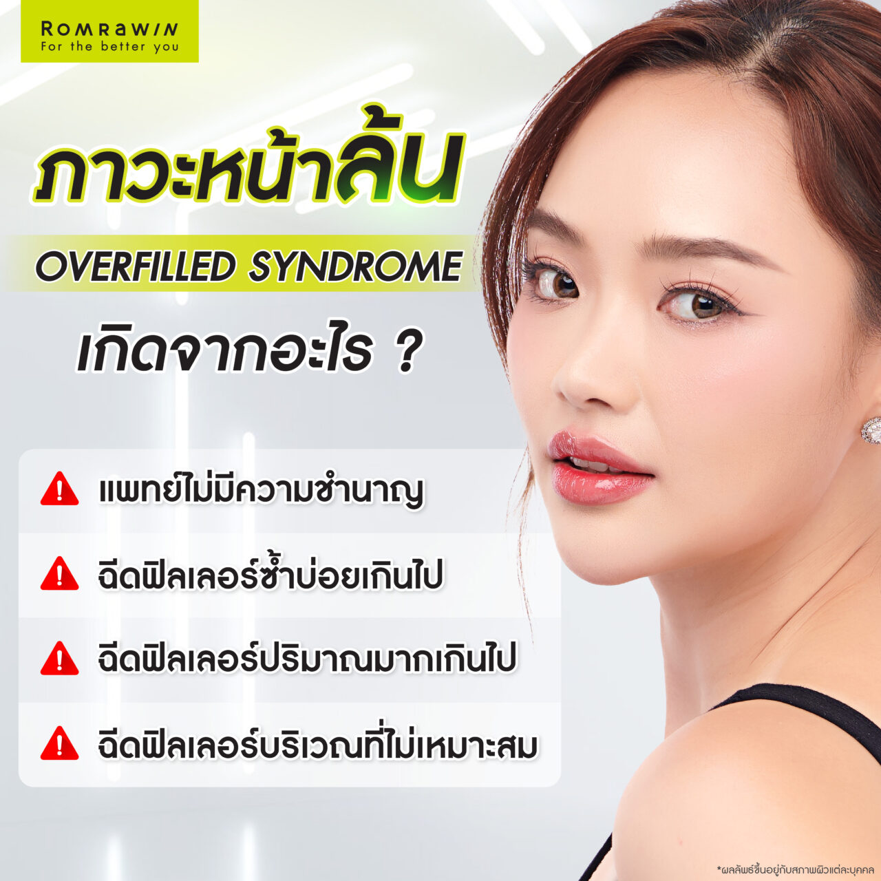 ภาวะหน้าล้น เกิดจากอะไร?