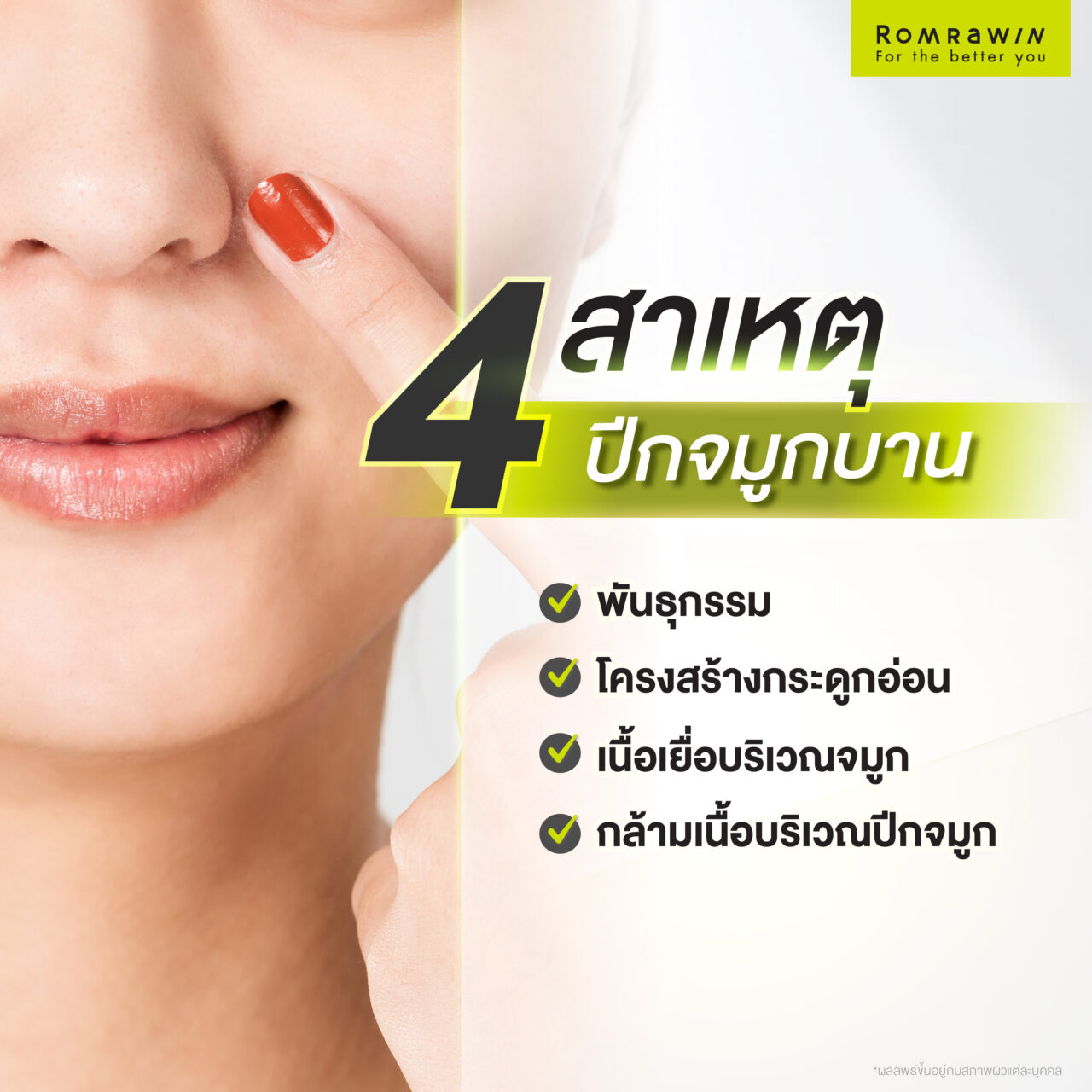 ปีกจมูกบาน เกิดจากสาเหตุอะไร?