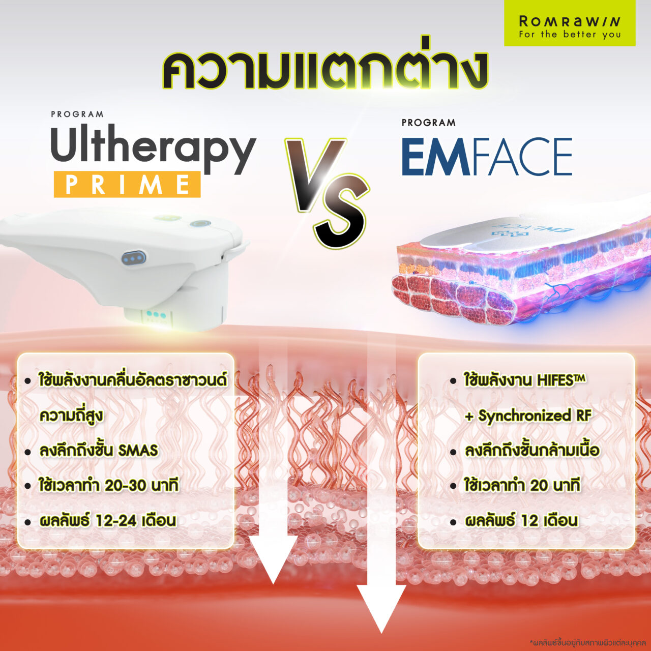 ความแตกต่างของยกกระชับผิวหน้าโปรแกรม Ulthera Prime และ โปรแกรม EMFACE