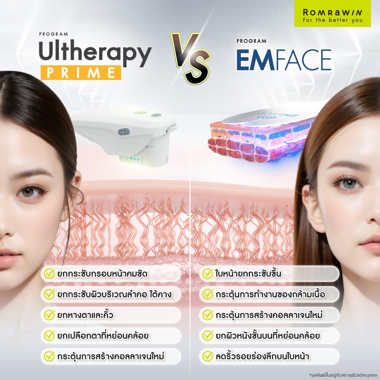 ยกกระชับผิวหน้าโปรแกรม Ulthera Prime และโปรแกรม EMFACE ช่วยอะไรบ้าง?