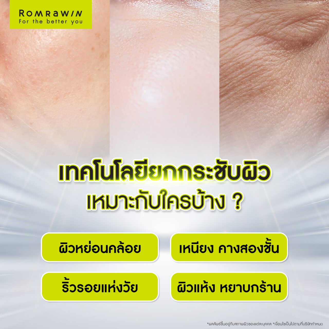 ใครบ้างที่เหมาะกับเทคโนโลยียกกระชับผิว แก้ปัญหาผิวหย่อนคล้อย?