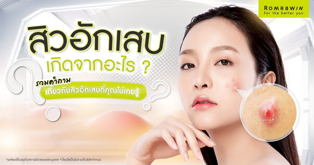 สิวอักเสบเกิดจากอะไร ? รวมคำถามเกี่ยวกับสิวอักเสบที่คุณไม่เคยรู้ 1 สิวอักเสบเกิดจากอะไร ?