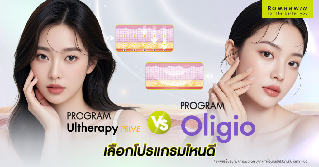 Ultherapy Prime vs Oligio โปรแกรมหน้าเรียวกระชับที่มาแรงในปีนี้ เลือกอะไรดี? 3 Ultherapy Prime vs Oligio โปรแกรมหน้าเรียวกระชับที่มาแรงในปีนี้ เลือกอะไรดี?