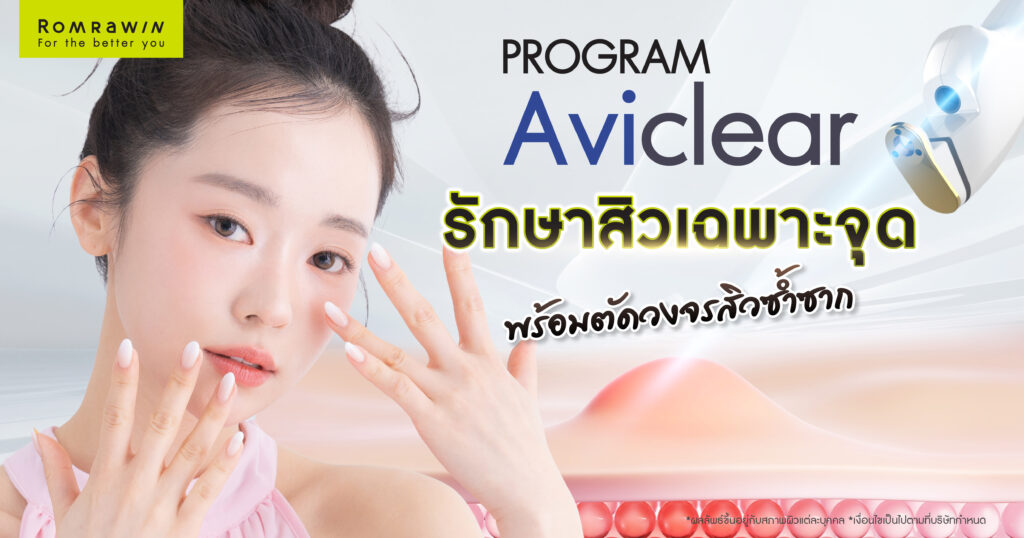 รักษาสิวเฉพาะจุดด้วย Aviclear พร้อมตัดวงจรสิวซ้ำซากทำได้อย่างไร 5 รักษาสิวเฉพาะจุด