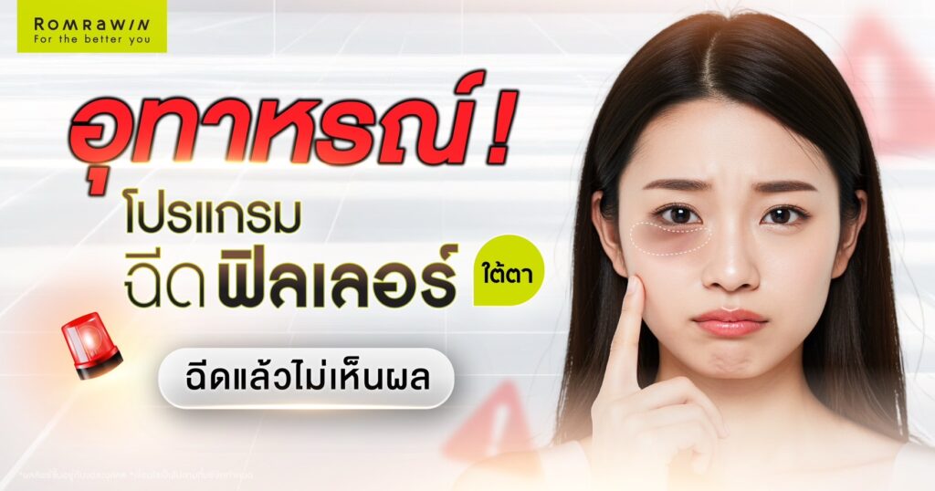 ฉีดฟิลเลอร์ใต้ตาแล้วไม่เห็นผล