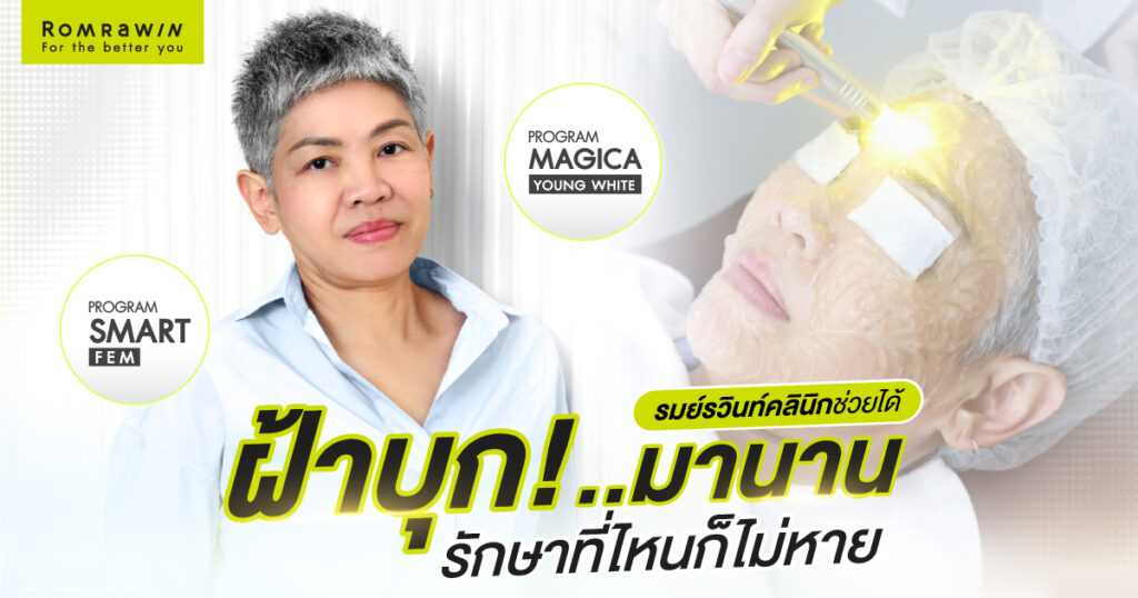 SMART FEM และ MAGICA YOUNG WHITE คุณฝน สิรินธร 1 SMART FEM และ MAGICA YOUNG WHITE คุณฝน สิรินธร