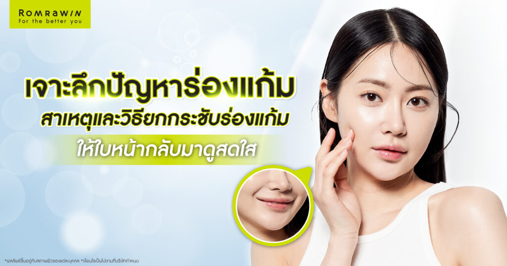 ปัญหาร่องแก้มลึก