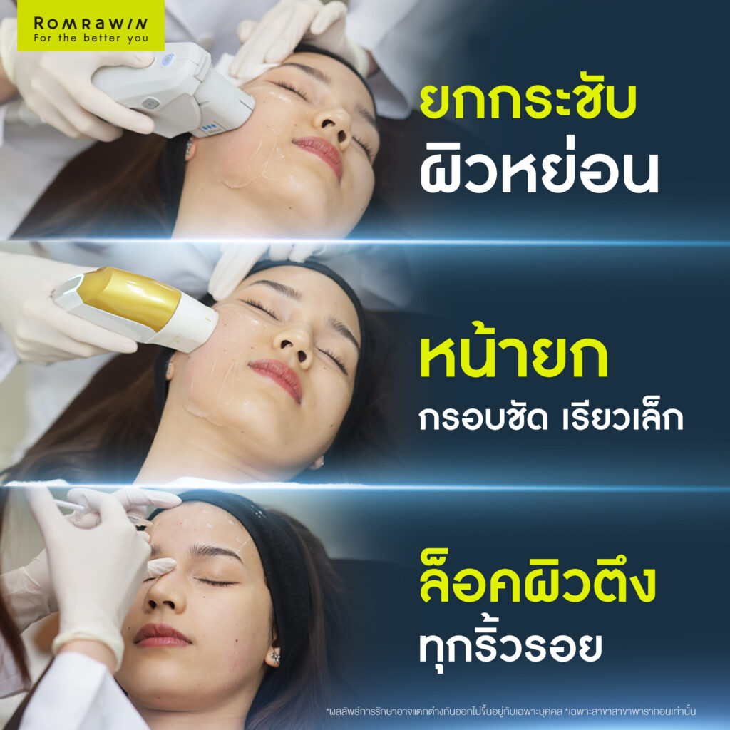 รวบตึง 3 ตัวท็อป โปรแกรมหน้ายุงที่คุณอัยยาเลือก