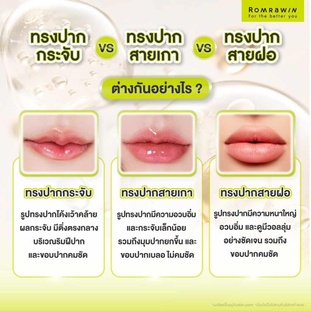 ทรงปากกระจับ กับ ทรงปากสายเกา กับ ทรงปากสายฝอต่างกันอย่างไร?