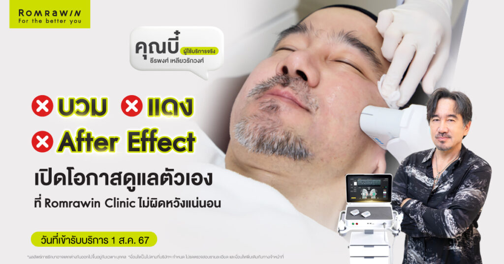 คุณบี๋ ธีรพงศ์ขอเปิดโอกาสดูแลตัวเองอีกครัง ด้วย Ultherapy PRIME 1 คุณบี๋ ธีรพงศ์ขอเปิดโอกาสดูแลตัวเองอีกครัง ด้วย Ultherapy PRIME