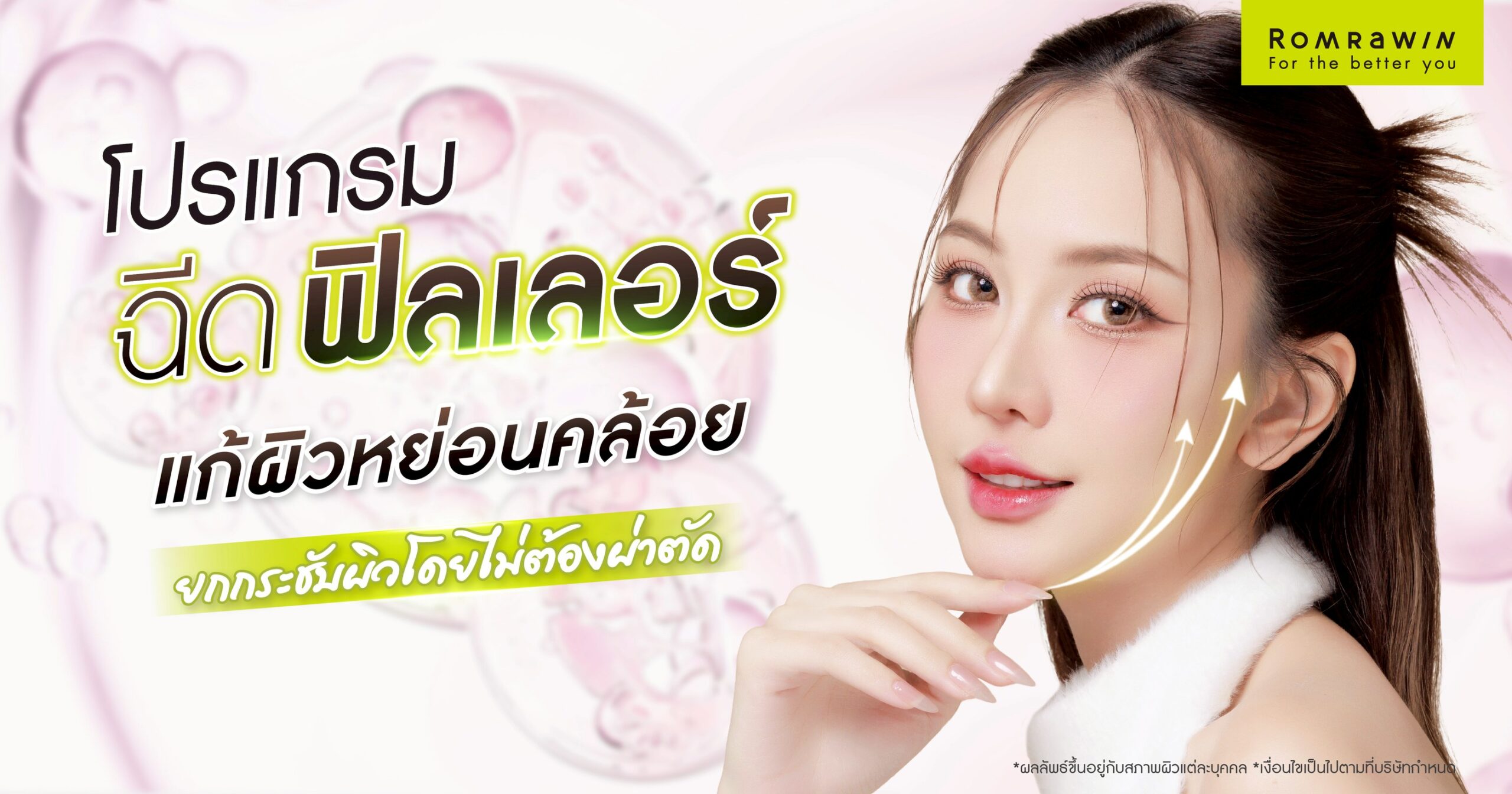 แก้ผิวหย่อนคล้อยด้วยฟิลเลอร์ ตัวช่วยยกกระชับผิว โดยไม่ต้องผ่าตัด