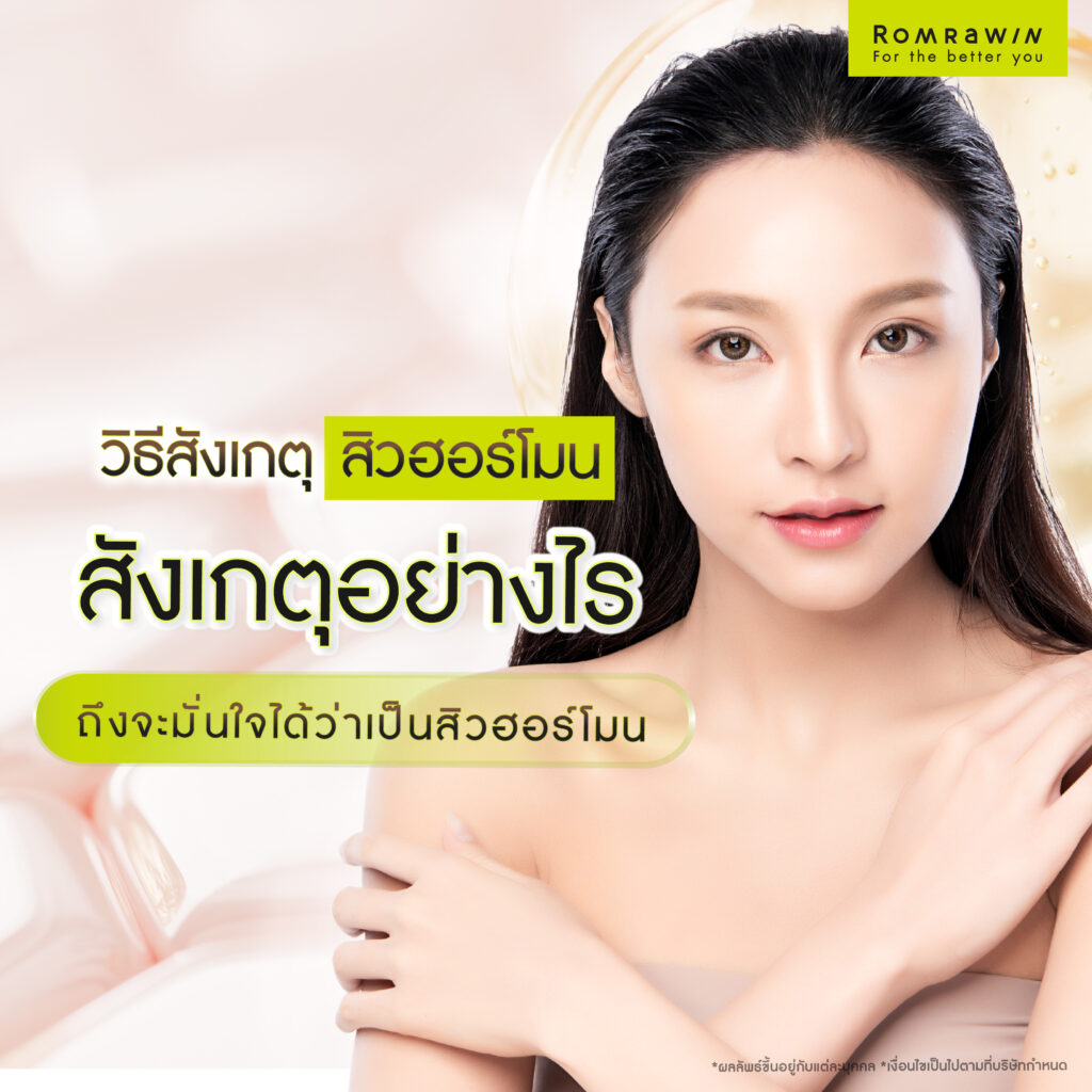 วิธีสังเกตุลักษณะของสิวฮอร์โมน