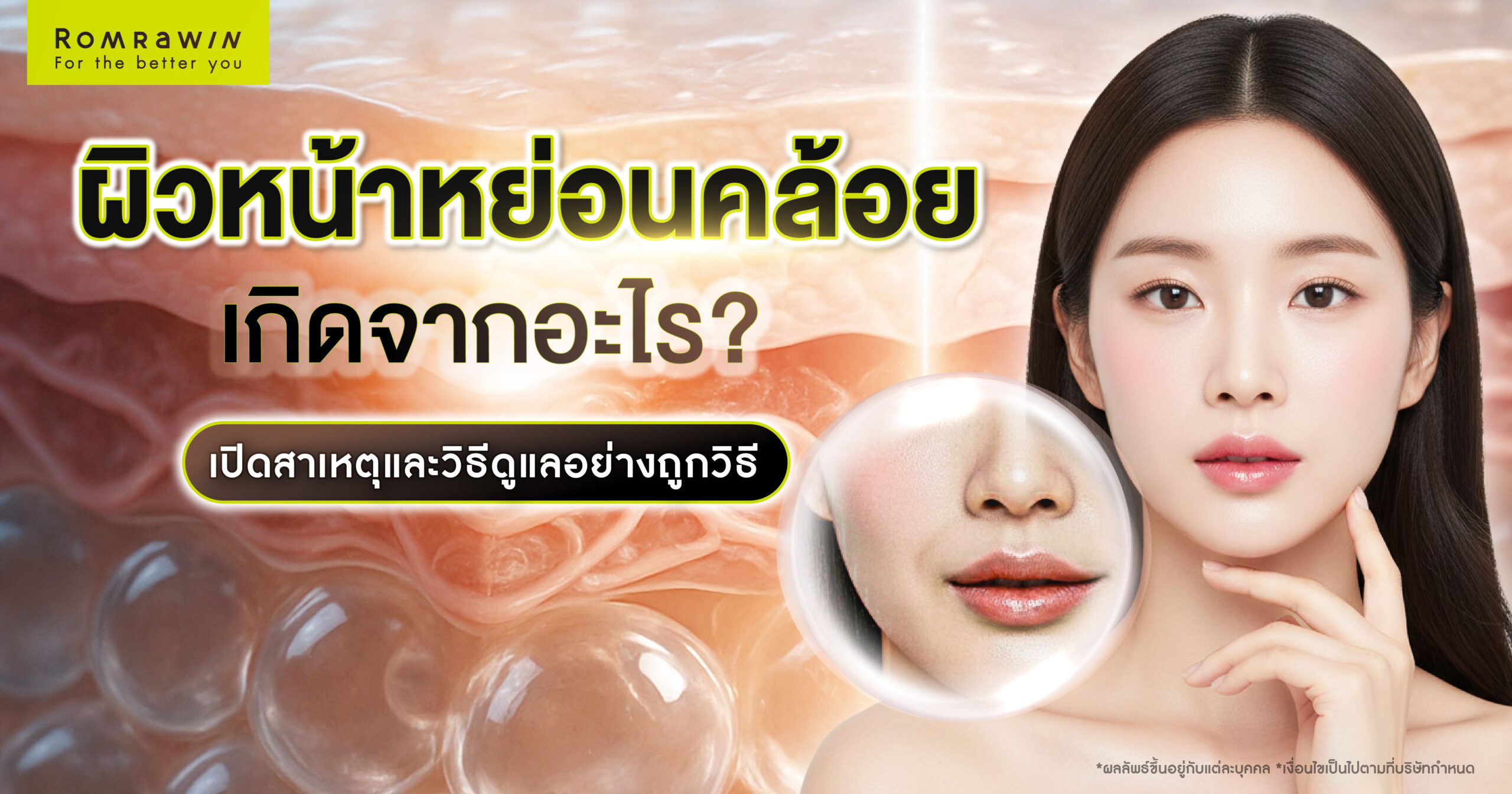 ผิวหน้าหย่อนคล้อย