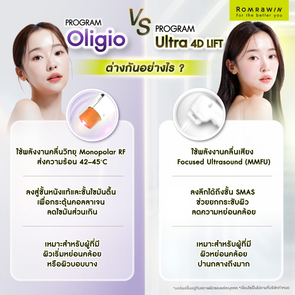 Oligio vs Ultra 4D Lift ต่างกันอย่างไร? รู้จักเทคโนโลยียกกระชับผิวและวิธีเลือกให้เหมาะกับคุณ 2 Oligio และ Ultra 4D Lift ต่างกันอย่างไร?
