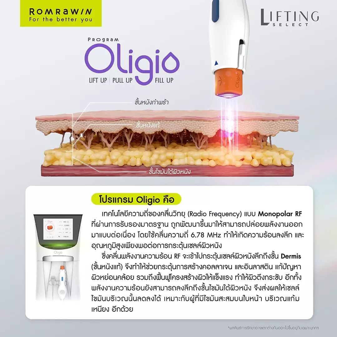 โปรแกรม Oligio คืออะไร