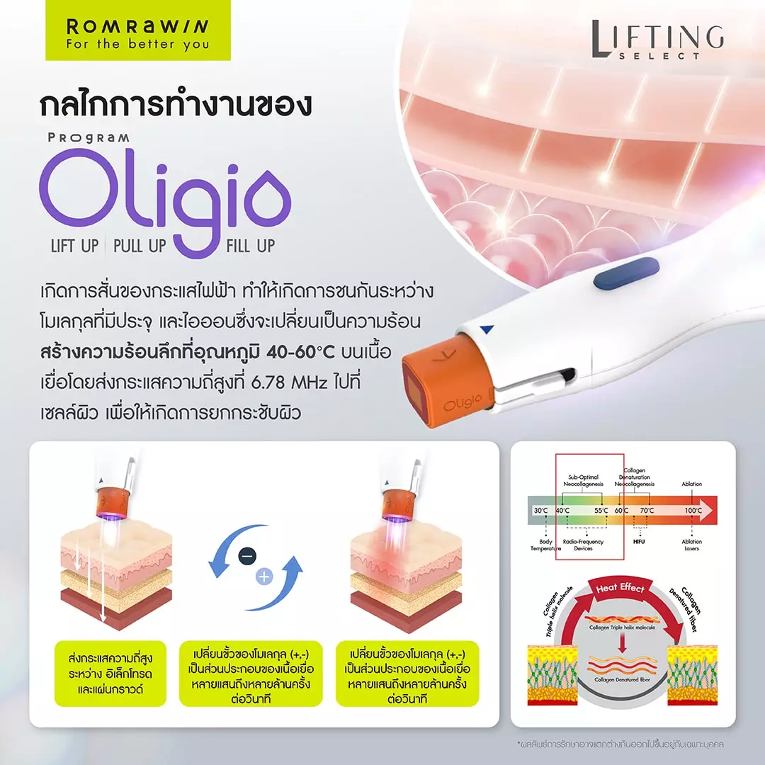 การทำงานของ โปรแกรม Oligio