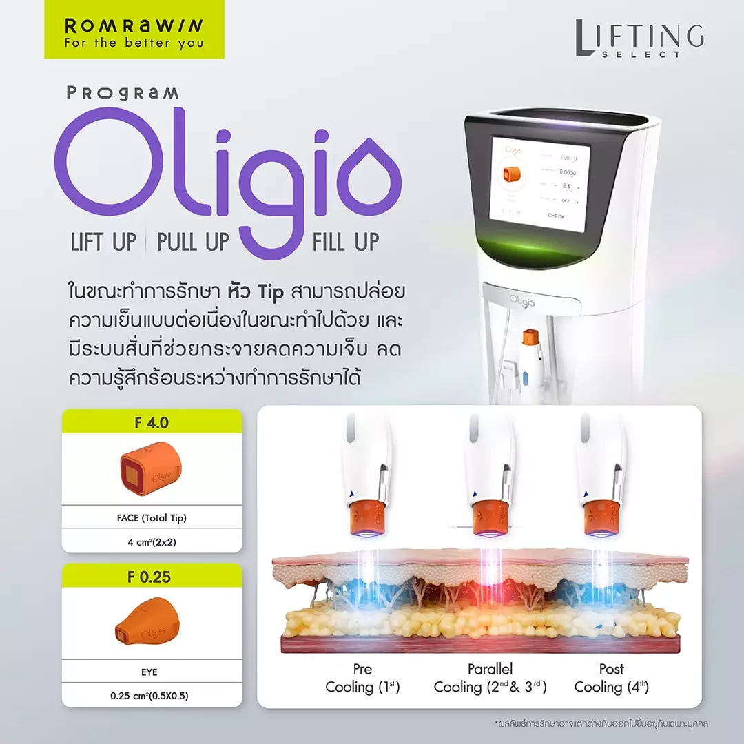 เทคนิคเฉพาะตัวของโปรแกรม OLIGIO FAST MOVING TECHNIQUE